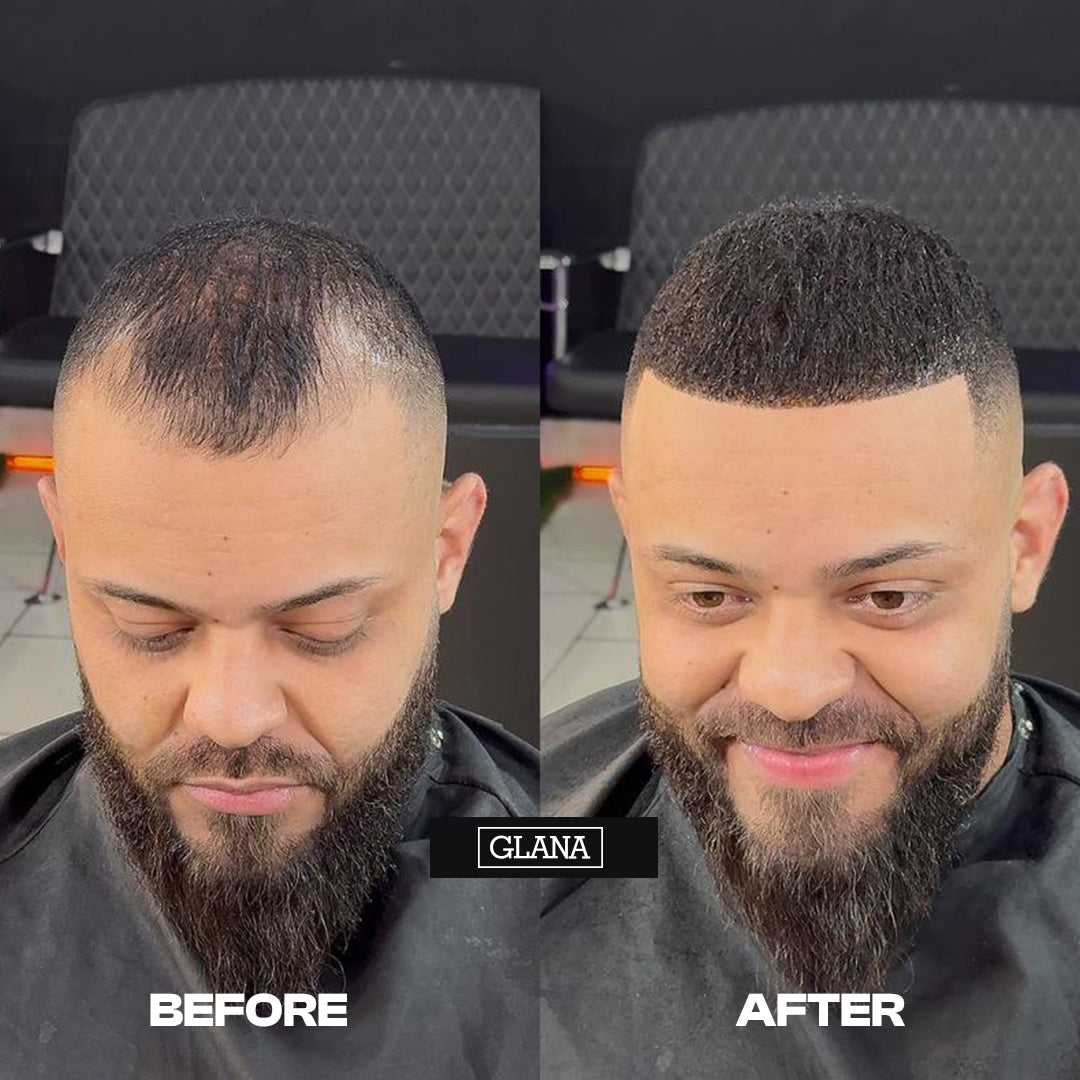 Hair Fibers Combo Kit