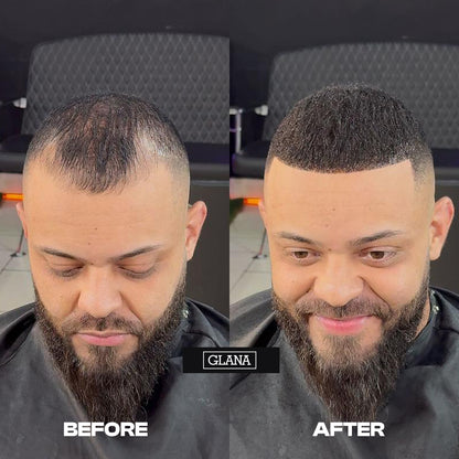 Hair Fibers Combo Kit